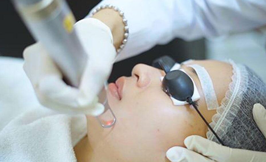 Pico Laser Tren di Kalangan Muda, Bikin Kulit Glowing