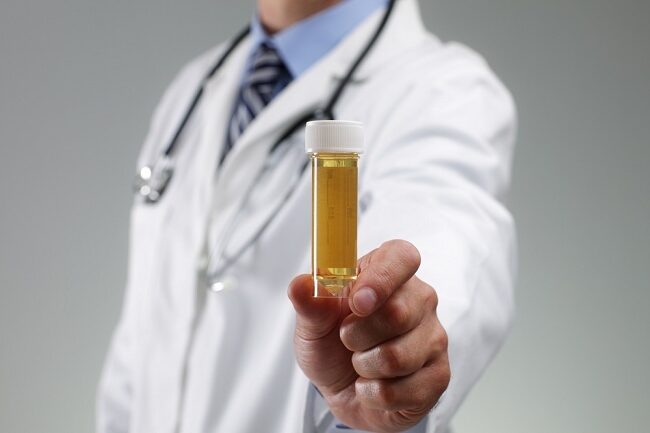 Tanda Kerusakan Ginjal yang Terlihat dari Warna Urine