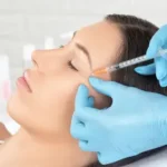Tren Treatment Collagen Stimulator di Berbagai Negara
